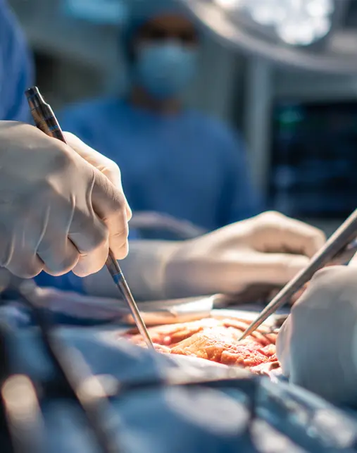 Liver transplant and HPB research